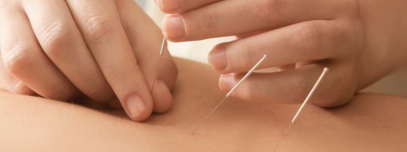 Acupuncture needle fear